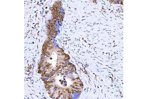 IHC analysis of Symplekin/SYMPK using anti-Symplekin/SYMPK antibody (ABIN7601558).