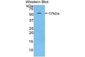 Western Blotting (WB) image for anti-PDGF-BB Homodimer (AA 5-225) antibody (ABIN3208201) (PDGF-BB Homodimer (AA 5-225) 抗体)