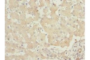 Immunohistochemistry of paraffin-embedded human liver tissue using ABIN7163408 at dilution of 1:100 (PHKB 抗体  (Regulatory Subunit beta))