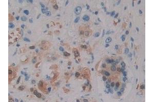 Immunohistochemistry (IHC) image for anti-Sorbitol Dehydrogenase (SORD) (AA 98-355) antibody (ABIN7433702)