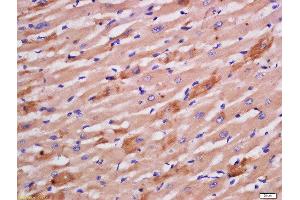 Formalin-fixed and paraffin embedded rat heart labeled with Rabbit Anti-Sarcomeric Alpha Actinin Polyclonal Antibody, Unconjugated  at 1:200 followed by conjugation to the secondary antibody and DAB staining (ACTN2 抗体  (AA 351-450))
