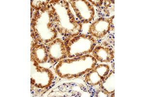 Immunohistochemical analysis of paraffin-embedded H. (ADRA1D 抗体  (N-Term))