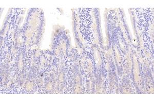 Detection of CD163 in Mouse Small intestine Tissue using Polyclonal Antibody to Cluster Of Differentiation (CD163) (CD163 抗体  (AA 697-972))