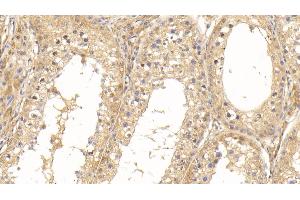 Immunohistochemistry (IHC) image for anti-Superoxide Dismutase 1, Soluble (SOD1) (AA 2-152) antibody (ABIN7426946)