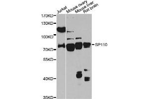Western blot analysis of extracts of various cell lines, using SP110 antibody (ABIN6290941) at 1:1000 dilution. (SP110 抗体)