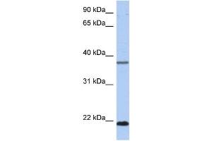 WB Suggested Anti-HDDC3 Antibody Titration: 0. (HDDC3 抗体  (Middle Region))