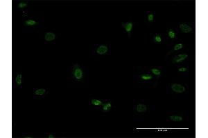 Immunofluorescence of monoclonal antibody to MEOX1 on HeLa cell. (MEOX1 抗体  (AA 82-170))
