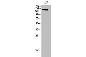Western Blot analysis of 3T3 cells using Phospho-FAK (Y576) Polyclonal Antibody (FAK 抗体  (pTyr576))