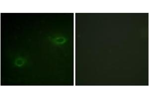 Immunofluorescence analysis of HeLa cells, using Syndecan4 (Ab-179) Antibody. (SDC4 抗体  (AA 145-194))