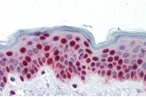 Human Skin: Formalin-Fixed, Paraffin-Embedded (FFPE) (PTBP1 抗体  (AA 45-145))