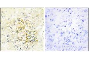 Immunohistochemistry analysis of paraffin-embedded human prostate tissue, using TMEPA Antibody. (TMEPA (AA 101-150) 抗体)