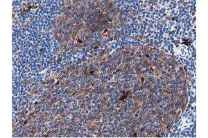 Image no. 8 for anti-Sequestosome 1 (SQSTM1) antibody (ABIN1499988) (SQSTM1 抗体)