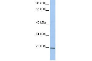 WB Suggested Anti-ZNF548 Antibody Titration:  0. (ZNF548 抗体  (C-Term))