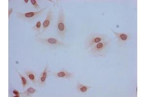 Immunocytochemistry analysis of Hela cells using ABIN7139185 at dilution of 1:100 (HIST1H2BB 抗体  (acLys5))