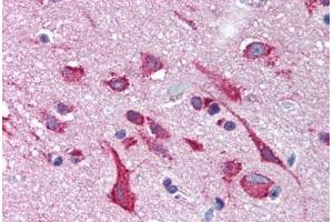 Immunohistochemistry (IHC) image for anti-Potassium Voltage-Gated Channel, Subfamily H (Eag-Related), Member 2 (KCNH2) (Internal Region) antibody (ABIN1048985)