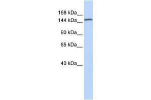 WB Suggested Anti-DGKH Antibody Titration:  0. (DGKH 抗体  (Middle Region))
