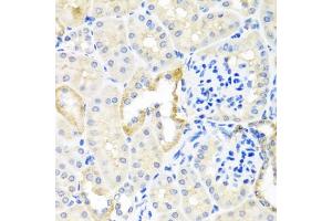 Immunohistochemistry of paraffin-embedded mouse kidney using TDGF1 antibody (ABIN3021341, ABIN3021342, ABIN3021343 and ABIN6214922) at dilution of 1:100 (40x lens).