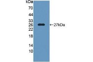 Detection of Recombinant SNAP25 using Polyclonal Antibody to Synaptosomal Associated Protein 25 kDa (SNAP25)