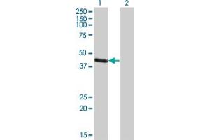 Western Blot analysis of MAGEA4 expression in transfected 293T cell line by MAGEA4 polyclonal antibody (A01). (MAGEA4 抗体  (AA 98-171))