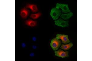 ABIN6256297 and ABIN6267410 staining Hela cells(4h of LPS treatment) by IF/ICC. (Connexin 43/GJA1 抗体  (pSer368))