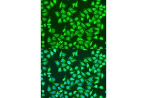 Immunofluorescence analysis of U2OS cells using SIRT4 antibody (ABIN7270326) at dilution of 1:100. (SIRT4 抗体  (AA 1-200))