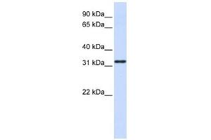 NANOS1 antibody used at 1 ug/ml to detect target protein. (Nanos Homolog 1 抗体)