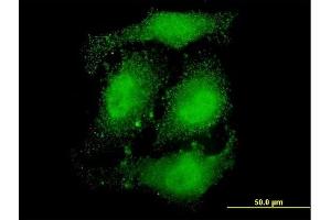 Immunofluorescence of monoclonal antibody to ATN1 on HeLa cell. (Atrophin 1 抗体  (AA 1-110))