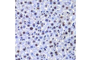Immunohistochemistry of paraffin-embedded mouse liver using PRKDC antibody. (PRKDC 抗体)