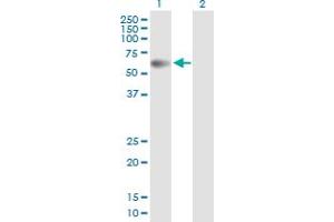 Western Blot analysis of PPM1B expression in transfected 293T cell line by PPM1B MaxPab polyclonal antibody. (PPM1B 抗体  (AA 1-479))