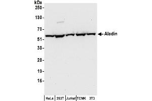Western Blotting (WB) image for anti-Achalasia, Adrenocortical Insufficiency, Alacrimia (AAAS) (AA 496-546) antibody (ABIN7455041)