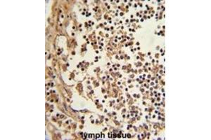 Immunohistochemistry (IHC) image for anti-Eukaryotic Translation Elongation Factor 1 delta (Guanine Nucleotide Exchange Protein) (EEF1D) antibody (ABIN3002663) (EEF1D 抗体)
