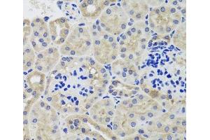 Immunohistochemistry of paraffin-embedded Mouse kidney using HK3 Polyclonal Antibody at dilution of 1:100 (40x lens). (HK3 抗体)