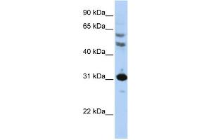 WB Suggested Anti-HOXB5 Antibody Titration: 0. (HOXB5 抗体  (N-Term))