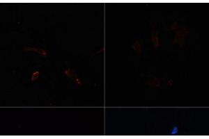 Immunofluorescence analysis of C6 cells using ACACA Polyclonal Antibody at dilution of 1:100.
