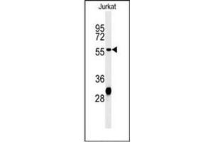 Western blot analysis of HADHB Antibody (C-term) in Jurkat cell line lysates (35ug/lane). (HADHB 抗体  (C-Term))