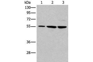 Western blot analysis of 293T and A172 cell lysates using TRIM27 Polyclonal Antibody at dilution of 1:600 (TRIM27 抗体)