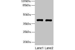 Western blot All lanes: MAB21L1 antibody at 6 μg/mL Lane 1: A375 whole cell lysate Lane 2: CEM whole cell lysate Secondary Goat polyclonal to rabbit IgG at 1/10000 dilution Predicted band size: 41 kDa Observed band size: 41 kDa (MAB21L1 抗体  (AA 1-359))