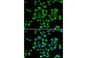 Immunofluorescence analysis of U2OS cells using RPS16 antibody. (RPS16 抗体)