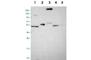 Western blot analysis of Lane 1: RT-4, Lane 2: U-251 MG, Lane 3: Human Plasma, Lane 4: Liver, Lane 5: Tonsil with COL17A1 polyclonal antibody . (COL17A1 抗体)