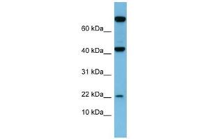 Leptin antibody used at 1 ug/ml to detect target protein. (Leptin 抗体  (N-Term))