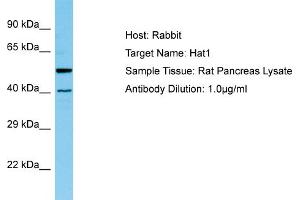WB Suggested Anti-Hat1 Antibody   Titration: 1. (HAT1 抗体  (N-Term))
