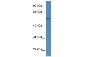 Western Blotting (WB) image for anti-Cytochrome P450, Family 51, Subfamily A, Polypeptide 1 (CYP51A1) (N-Term) antibody (ABIN926424)