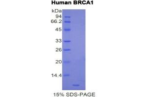 SDS-PAGE analysis of Human BRCA1 Protein. (BRCA1 蛋白)