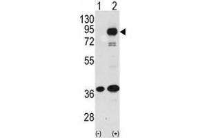 Image no. 1 for anti-Prospero Homeobox 1 (PROX1) (C-Term) antibody (ABIN357417)