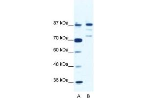 WB Suggested Anti-BACH1 Antibody Titration:  1. (BACH1 抗体  (C-Term))