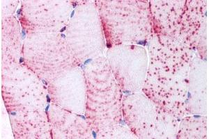 Human Skeletal Muscle, Myocytes (formalin-fixed, paraffin-embedded) stained with TNIK antibody ABIN213549 at 5 ug/ml followed by biotinylated goat anti-rabbit IgG secondary antibody ABIN481713, alkaline phosphatase-streptavidin and chromogen. (TNIK 抗体  (Internal Region))