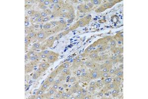 Immunohistochemistry of paraffin-embedded human liver injury using μgT2B10 antibody (ABIN5975607) at dilution of 1/100 (40x lens). (UGT2B10 抗体)