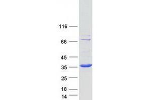 Western Blotting (WB) image for Enoyl CoA Hydratase Domain Containing 1 (ECHDC1) (Transcript Variant 5) protein (Myc-DYKDDDDK Tag) (ABIN2719919)