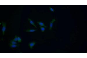Detection of GSTM1 in Human HepG2 cell using Polyclonal Antibody to Glutathione S Transferase Mu 1 (GSTM1) (GSTM1 抗体  (AA 1-220))