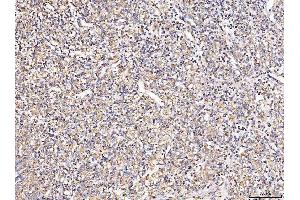 IHC analysis of MT-CO2 using anti-MT-CO2 antibody (ABIN7599081). (COX2 抗体  (AA 1-205))